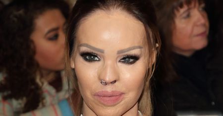 Katie Piper, ofiara strasznego ataku, uratowała ludzi z płonącego budynku