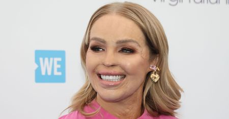 Poparzona Katie Piper ignorowała objawy choroby. Trafiła do szpitala