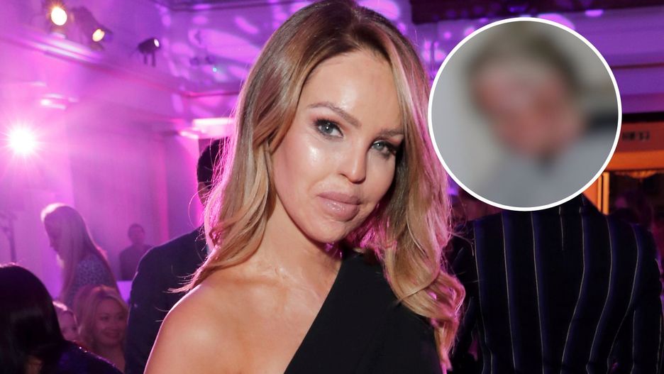 Katie Piper jeszcze raz wróciła do swojej poruszającej historii