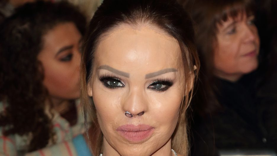 Katie Piper ma za sobą traumatyczne doświadczenia. Nie załamała się