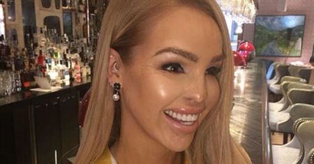 Poparzona Katie Piper pokazała się bez makijażu. "To było trudne!"