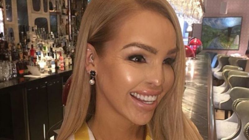 Katie PIper nie wstydzi się blizn