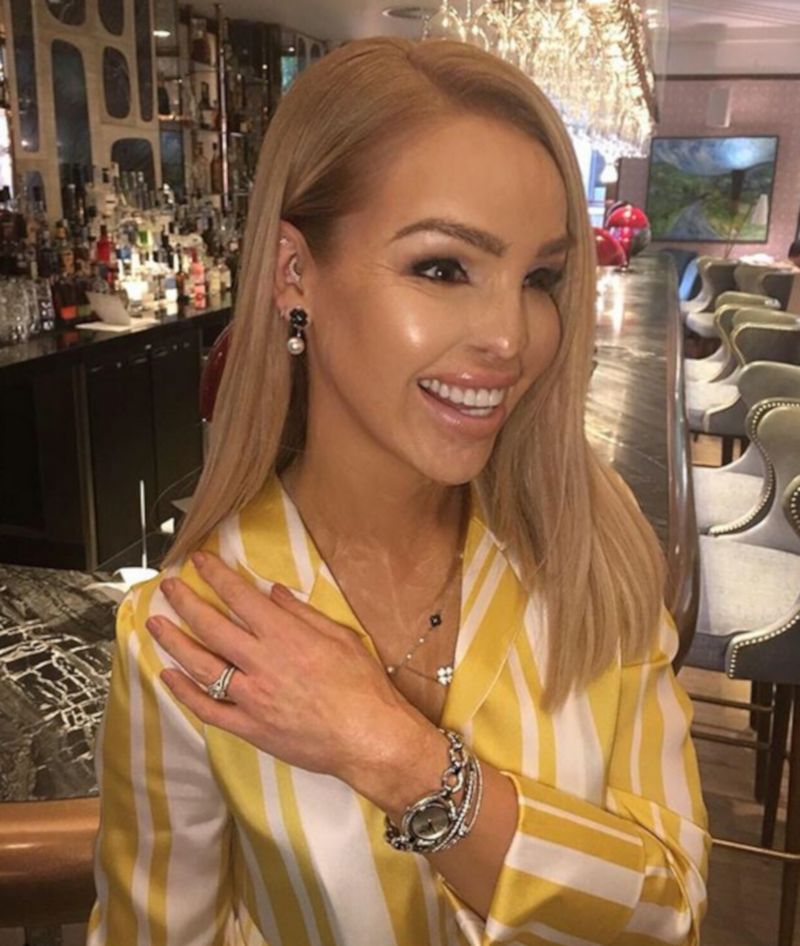 Poparzona Katie Piper pokazała się bez makijażu. "To było trudne!"