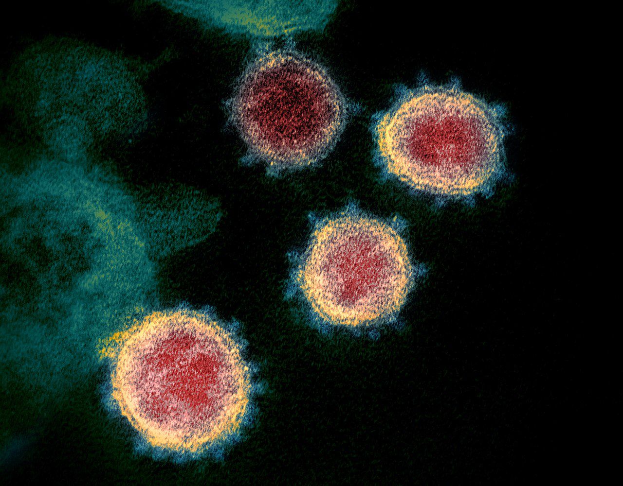 COVID-19 rozwija się u pacjentów zainfekowanych innymi wirusami. Nowe wyniki badań