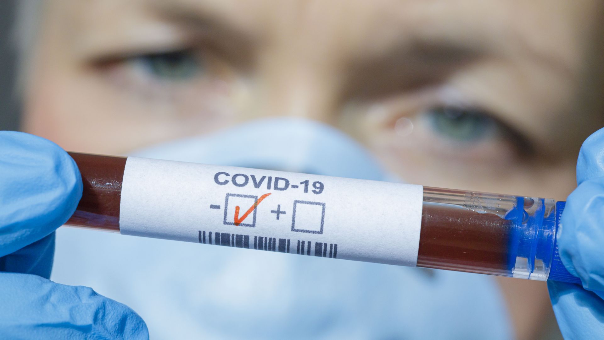 Covid-19, wynik ujemny. Do tego dąży cały świat