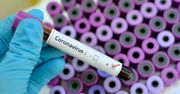 Grecja potwierdza doniesienia. Koronawirus w Salonikach
