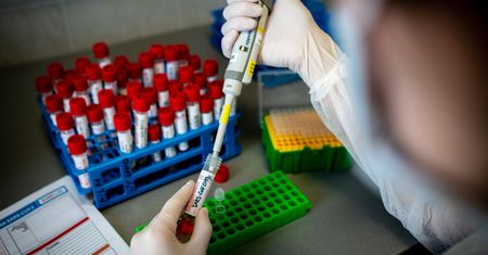 Koronawirus. Polska opracuje swój test na SARS-CoV-2