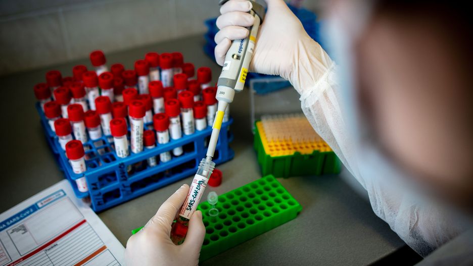 Koronawirus. Polska opracuje swój test na SARS-CoV-2