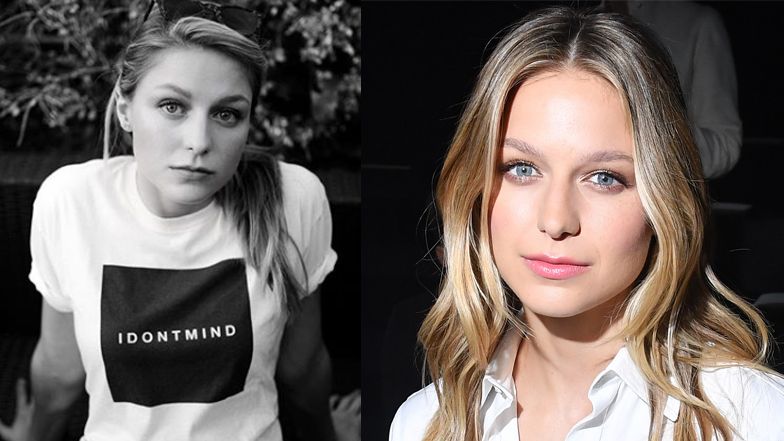 Melissa Benoist OFIARĄ PRZEMOCY DOMOWEJ. "Prawie rozerwało mi gałkę oczną"