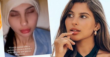 Eliza z "Hotelu Paradise" po fali hejtu zdecydowała się na operację odstających uszu. Pokazała efekt. "Jest tragicznie"