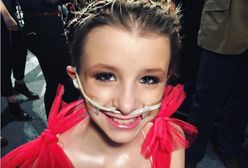 11-letnia modelka przegrała walkę z rakiem