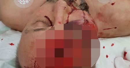 Niemiecki polityk został ciężko pobity. W tym roku spokoju nie będzie