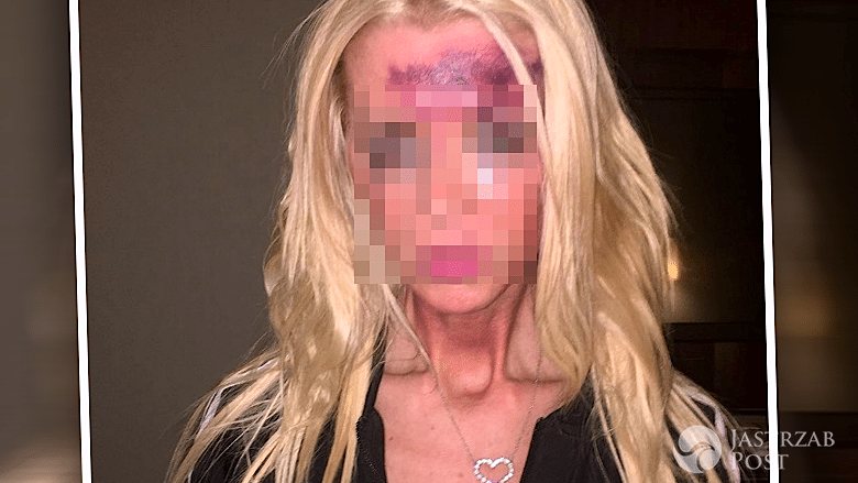 Tara Reid pobita