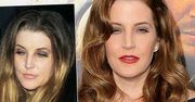 Wczoraj czerwony dywan, a dzisiaj walka o życie! Lisa Marie Presley wylądowała na ostrym dyżurze. Wieści nie napawają optymizmem