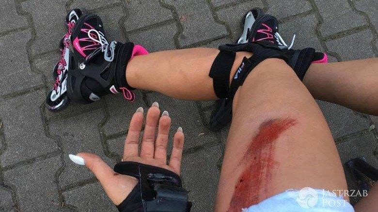 Polska gwiazda miała wypadek! Nie wygląda to dobrze...