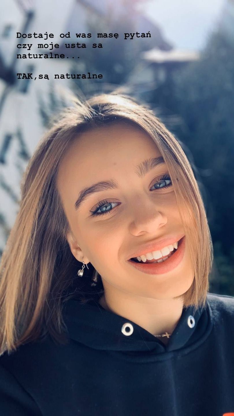 Oliwia Bieniuk poprawiała sobie usta?