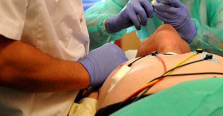 Za dwa lata włoski neurochirurg chce wykonać pierwszy przeszczep głowy