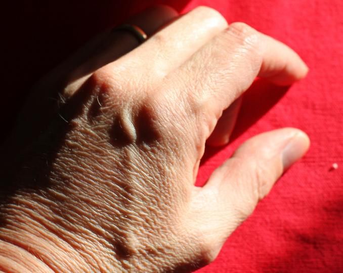 Czynniki ryzyka choroby Parkinsona - objawy 