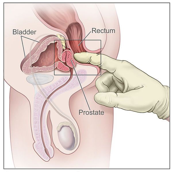 Schemat badania per rectum 