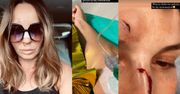 Agnieszka Włodarczyk zabrana karetką do szpitala. "Obudziłam się we krwi". Pokazała zdjęcia zmasakrowanej twarzy