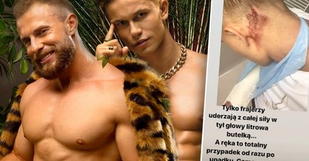 Hotel Paradise: Łukasz oskarża Kamila o pobicie butelką. Co on na to? Mamy mocny komentarz [WIDEO]