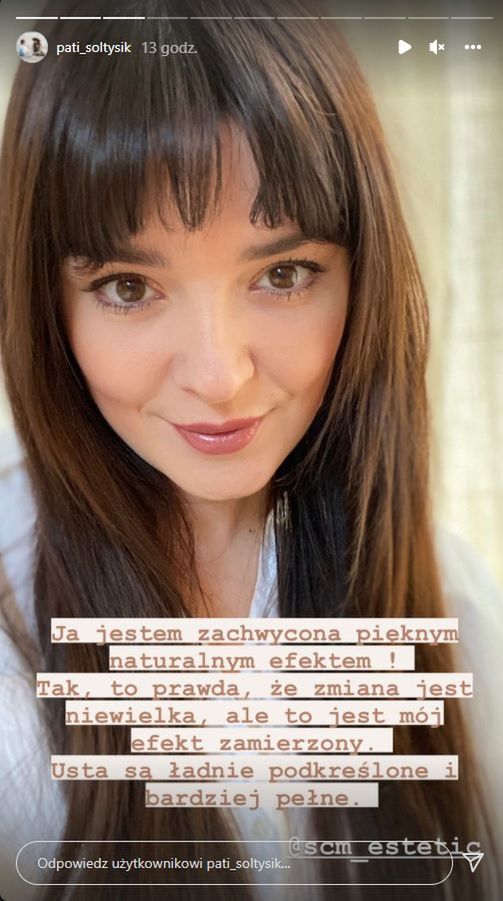 Patrycja Sołtysik powiększyła usta