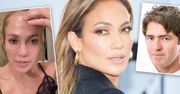 Lekarz polskich gwiazd ocenił twarz Jennifer Lopez. Stosuje botoks? Wnioski są zadziwiające