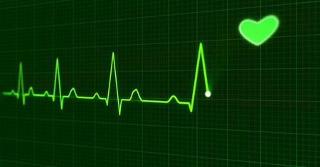Opracowane przez polski start-up elektrody pozwalają wykryć o 20 proc. więcej zawałów serca niż klasyczne EKG. Zamiast 10 elektrod wystarczy jedna naklejka