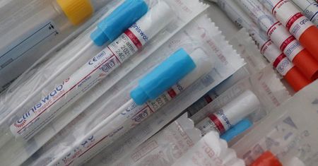 Walka z HIV w Szczecinie i Koszalinie: anonimowe i darmowe testy.