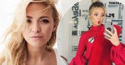 Barbara Kurdej-Szatan po operacji plastycznej! Jak teraz wygląda? Aktorce na usta cisną się niecenzuralne słowa