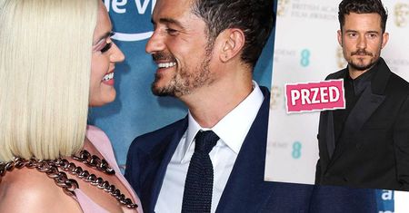 Niezwykła przemiana Orlando Blooma. Katy Perry pęka z dumy: „Zmienił się w Hulka”