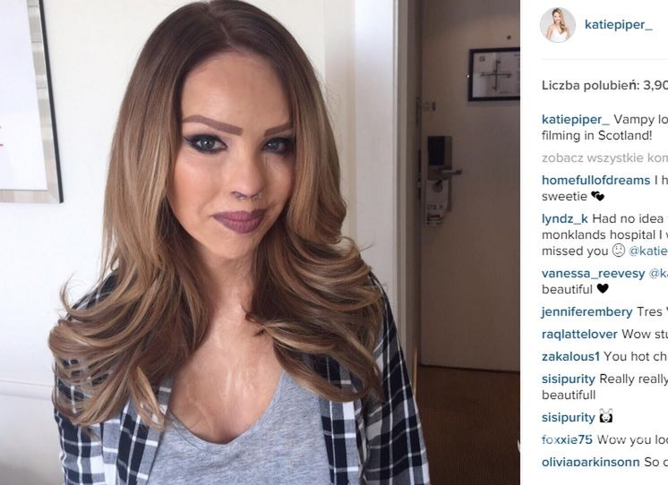 Katie Piper fot.Instagram.com