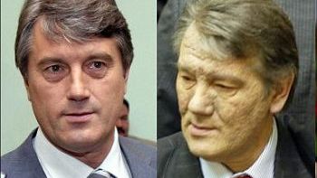 Wiktor Juszczenko przed i po zatruciu