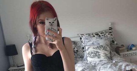 Podniosła spódnicę, zrobiła zdjęcie i opowiedziała o chorobie, której na co dzień nie widać