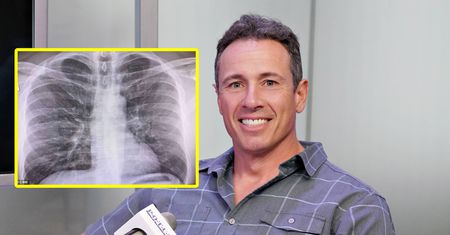 Chris Cuomo, dziennikarz CNN pokazał rentgen swoich płuc. Jest zakażony koronawirusem