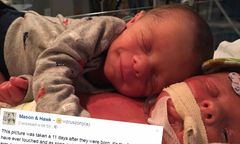 Wzruszająca historia bliźniaków, których zdjęcie podbiło internet