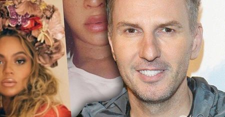 Krzysztof Gojdź o ustach ciężarnej Beyonce: "Na zdjęciach widać ewidentnie powiększone usta, które..."