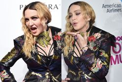 Madonna nie przestaje eksperymentować z twarzą