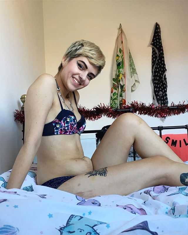 Chorowała na anoreksję 10 lat. Teraz zdrowym ciałem chwali się na Instagramie