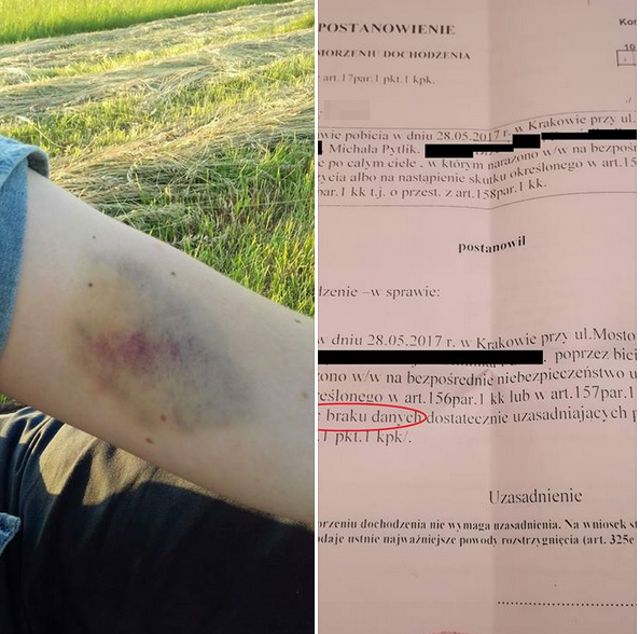 Pobili ich, bo rozmawiali o gejach. Policja umorzyła śledztwo z "braku danych"