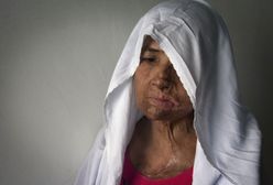 Prawo islamskie pozwala "lekko" uderzyć żonę. Rezultaty są straszne