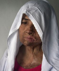 Prawo islamskie pozwala "lekko" uderzyć żonę. Rezultaty są straszne