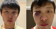 Rasistowski atak na studenta z Singapuru. Powodem koronawirus