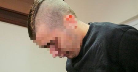 Łódź. Pobicie 4-miesięcznego dziecka. Ojciec usłyszał zarzut usiłowania zabójstwa córeczki