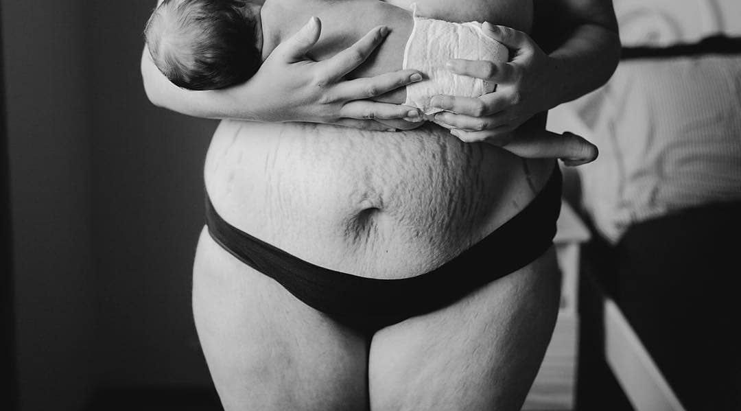 Brzuszek i blizny po porodzie? To nie problem, przekonują zdjęcia kobiet na Instagramie