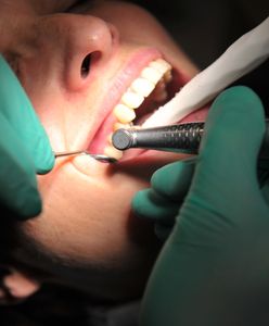 Koronawirus w Polsce. Oby nie rozbolały was zęby. Dentyści właśnie zamknęli gabinety