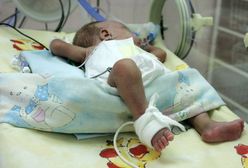 Dwumiesięczne niemowlę z podejrzeniem pobicia na OIOM-ie