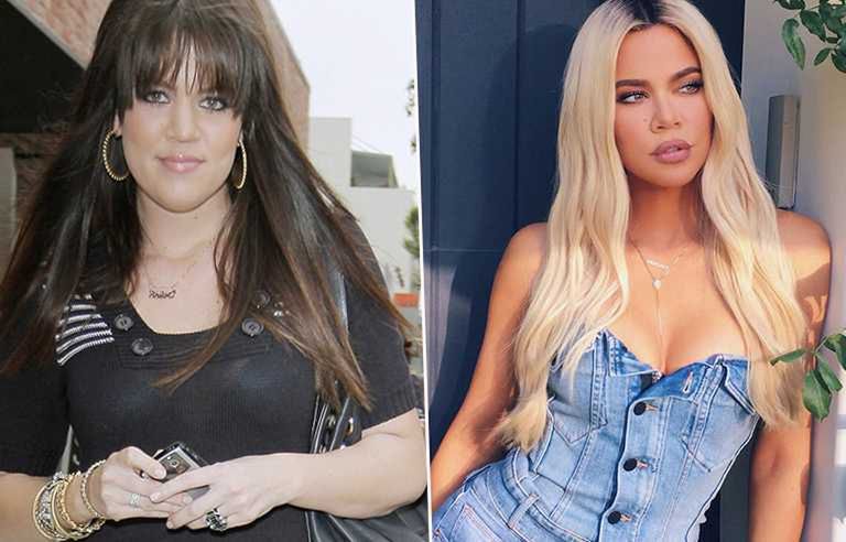 Khloe Kardasiahian - przed i po operacji biustu
