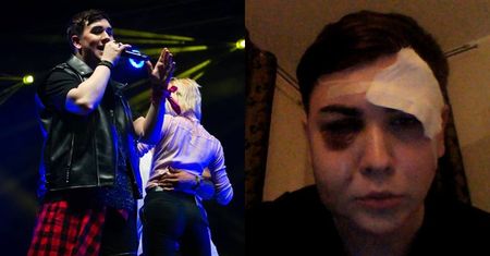 Muzyk pobity po gali disco polo. Usłyszał, że "nie powinien żyć"
