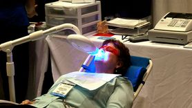 Wybielanie zębów u stomatologa